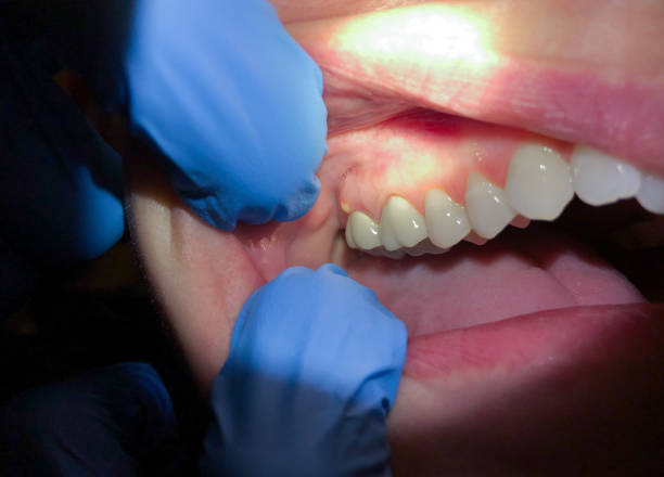 Best Emergency TMJ Treatment in Ford Heights, IL