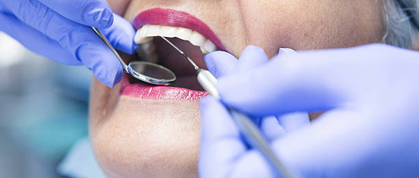 Best Emergency Tooth Extraction in Ford Heights, IL